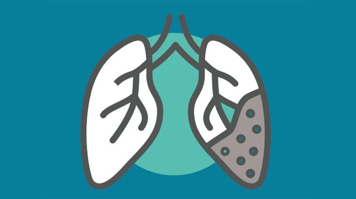 Icon of lungs for World No Tobacco Day